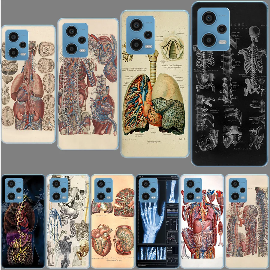 Medical Human Organs Brain Case for Redmi Note 12 Pro 11 Pro Plus 12S 11S 11T 11E 10 5G 10S 9S 9T 9 8T 8 7 Phone TPU Clear Cover