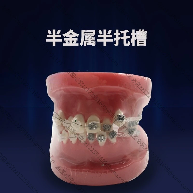 Suitable for Teaching Model Detachable Teaching Ready Denture Model Ornament