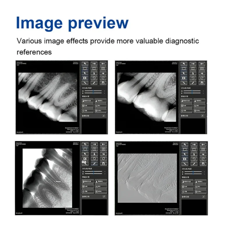 엑스레이 센서 장착 치과 센서, 거치대 Rx 디지털 HD 구강 이미징 시스템, RVG 센서