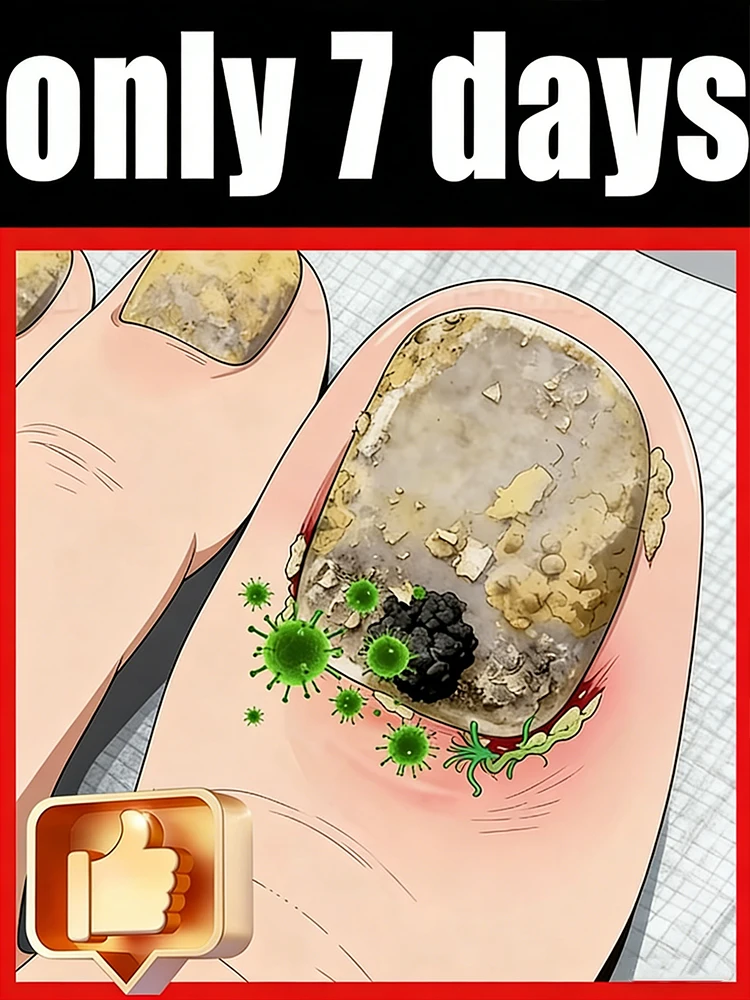 

Great news! Free shipping in 2026! Nail care solution, 10ml