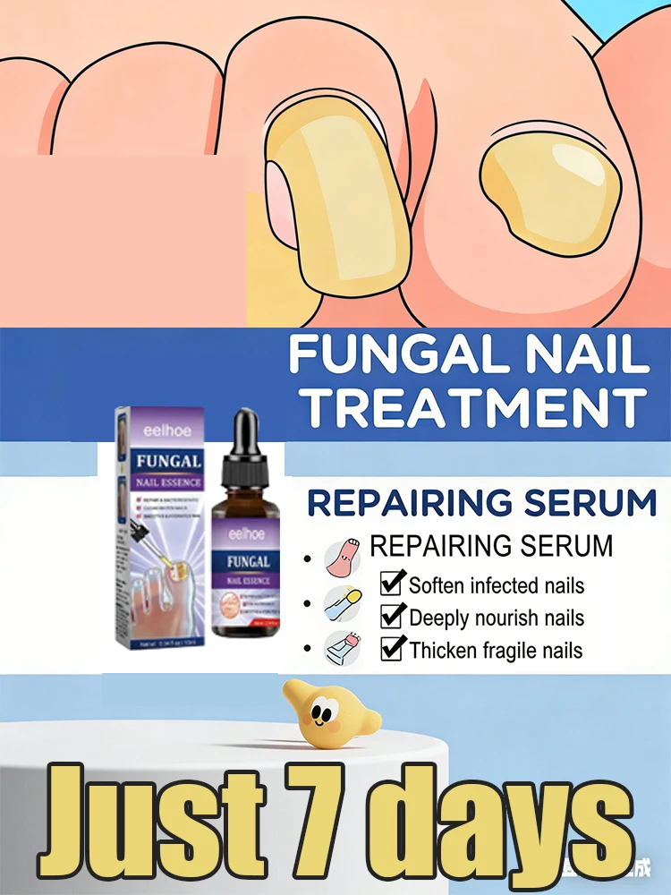 Upgraded Rejuvenator - Fungus Prevention Technology - Adjustable Control & Safety Sensor Fungal Repair Products  Hand Foot Care
