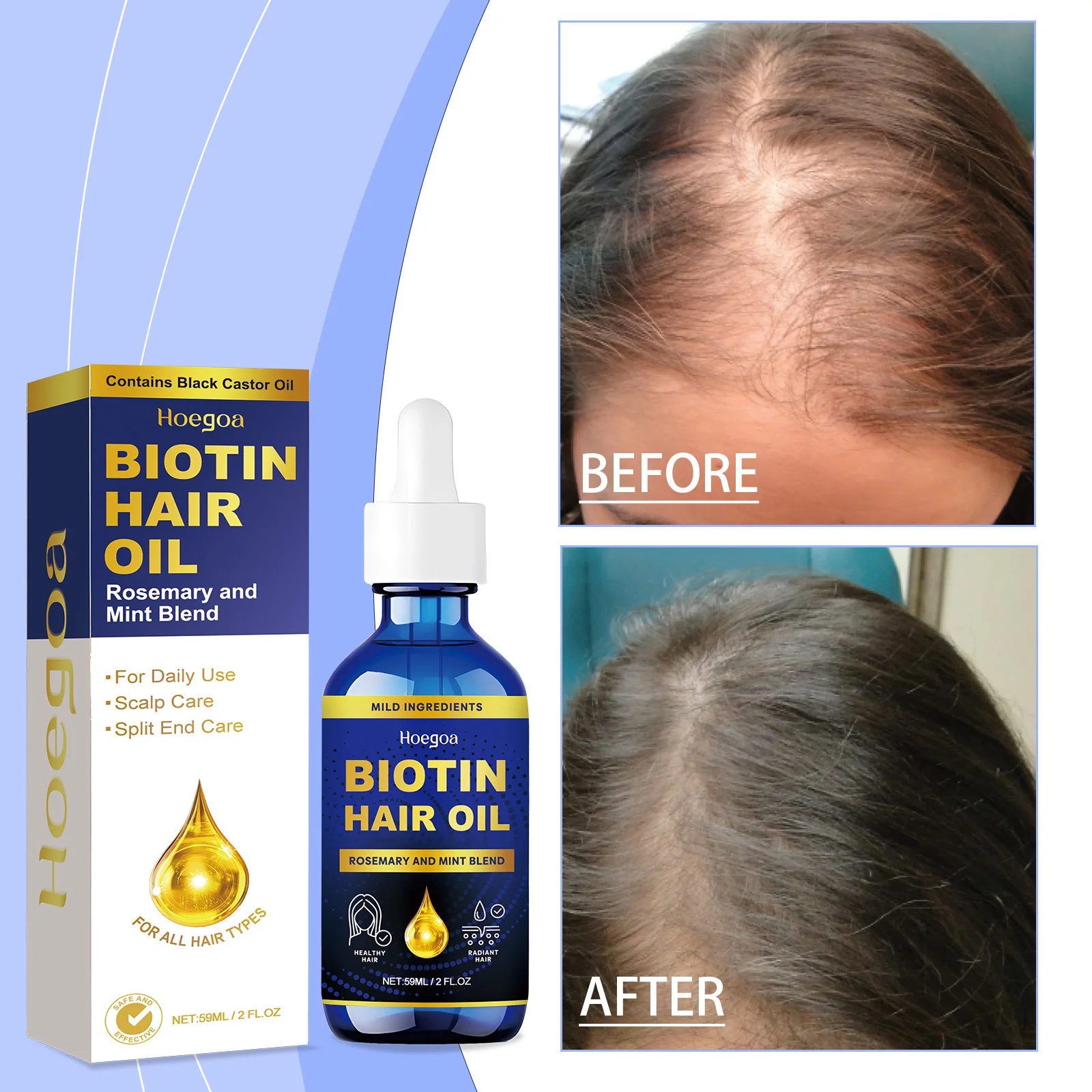 

2026 Hot promotes hair growth, hair growth oil, prevents baldness, repairs damage, scalp massage, mois