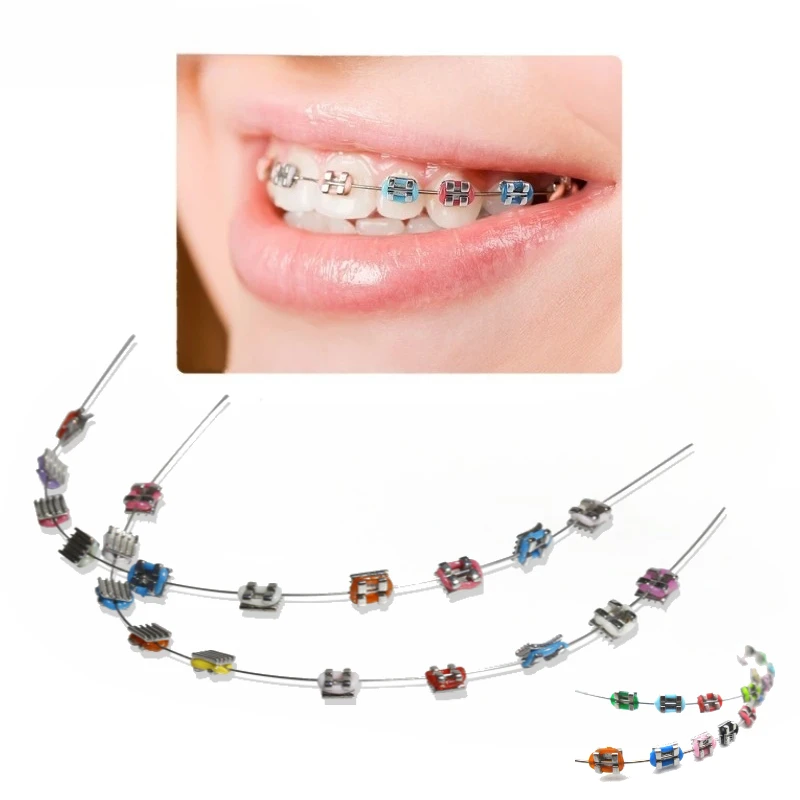 Fashion 1 Pair Dental Braces Colorful Temporary Teeth Decoration Metal Bracket Arch Wires Orthodontic Ligature Ties High Quality