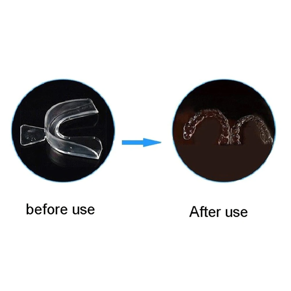 2/4pcs Soft Tooth Orthodontic Braces Set Replacement Teeth Mouth Guard Protector Whitening Trays Multi-function Hygiene Care