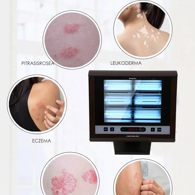 Kn-4006B1 Medicine Phototherapy Uv Lamp Phototherapy Desktop Uvb Light for Vitiligo Psoriasis Eczema