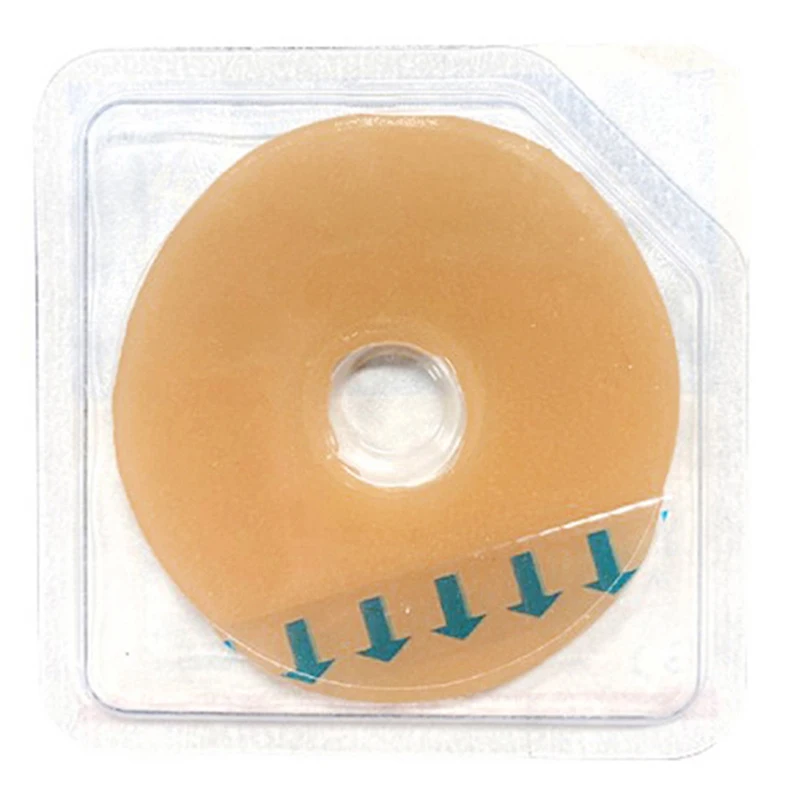 Ostomy Paste Ring Baseplates Stoma Care Leak-Proof Ring For Ostomy Bag Stretch Shaping To Prevent Leakage Protect