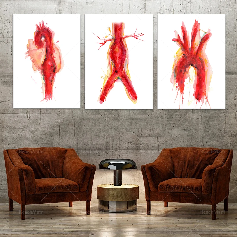 Cardiovascular Watercolor Art Print - Abdominal Aneurysm, Aorta and Thoracic Aneurysm - Anatomy Art Print Poster