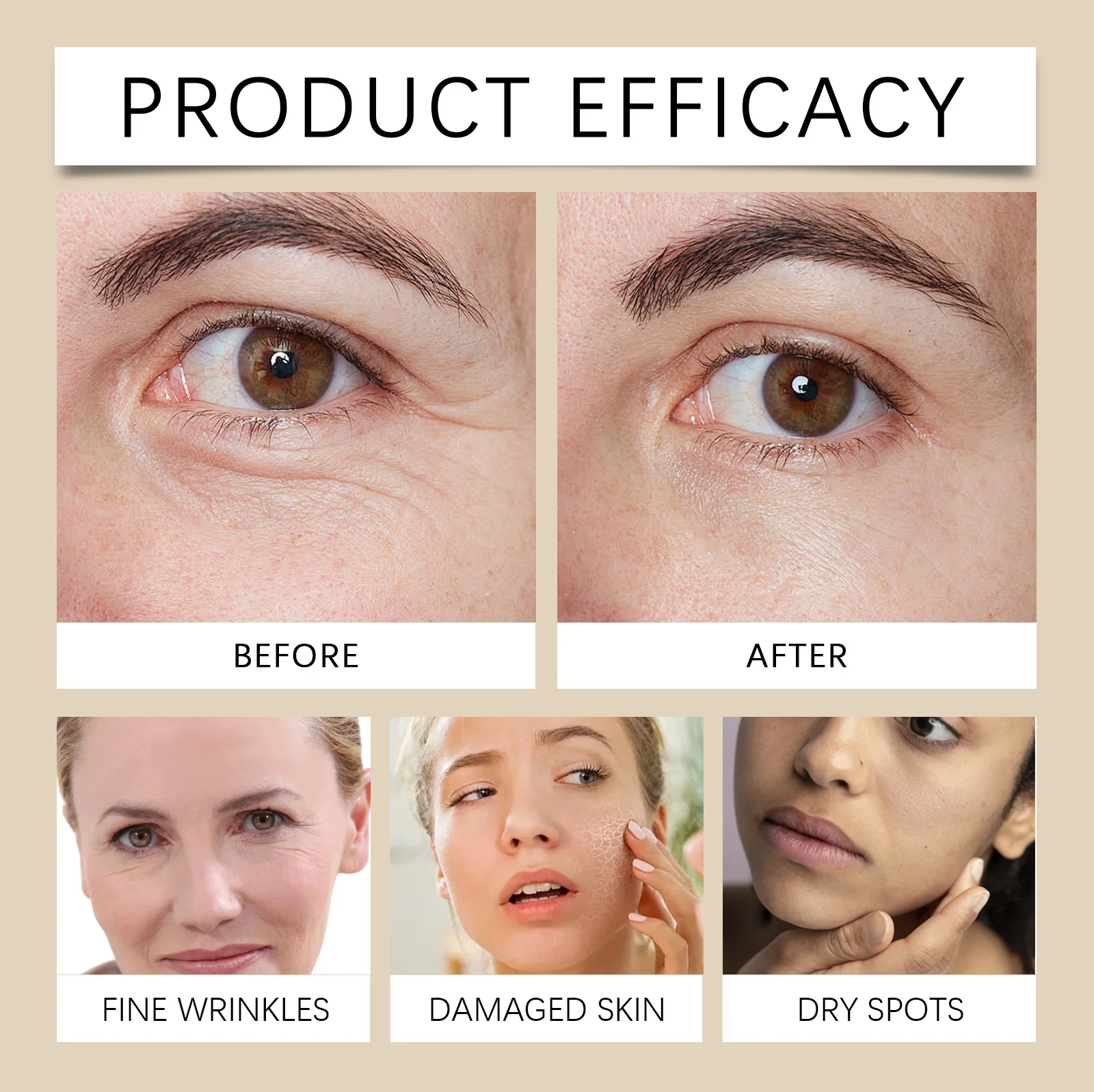 مصل ترطيب الوجه مع حمض الهيالورونيك للعناية بالبشرة الشتوية للبشرة الجافة والرطوبة والمظهر العلاج المغذي 30 مللي