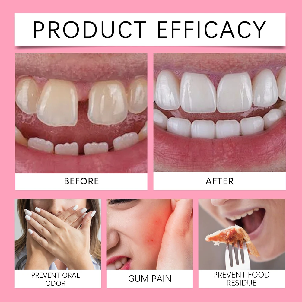 تثبيت التثبيت الطويل الطويلة للادة ، التثبيت الطويل الأمد ، يمنع تخفيف الأسنان المزيفة تحسين راحة العناية بالأسنان