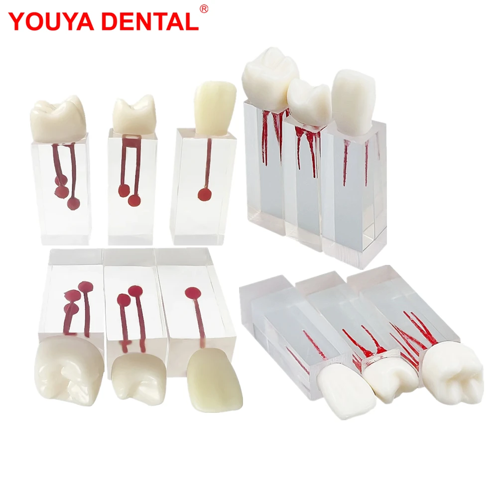 

3Pcs/set Dental Endodontic Root Canal Blocks Endo Pulp Cavity RCT Practice Treatment Training Teeth Teaching Model With Crown