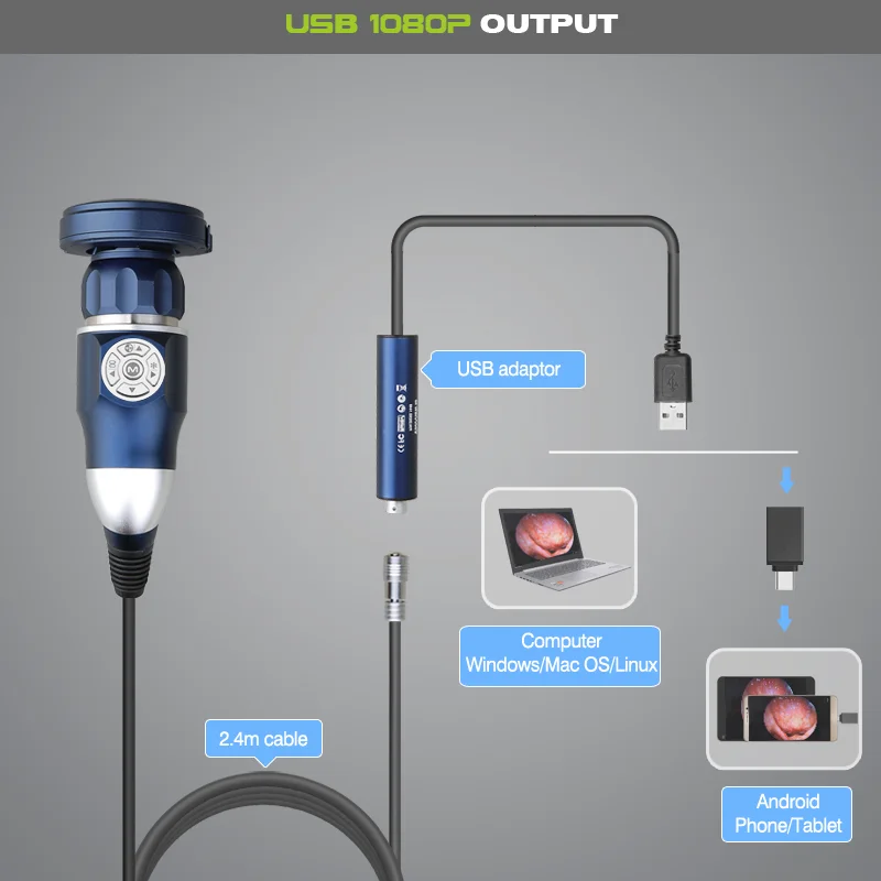 Advanced Protable Medical HD 1080P Endoscopy Camera for Surgery and Teaching