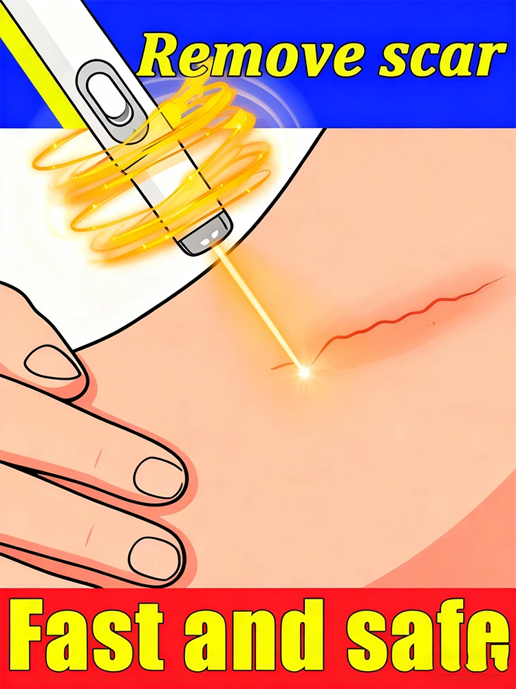 

Скажи прощайте шрамы! Лазерные неинвазивные технологии обеспечивают безопасное, быстрое восстановление и долговечные результаты для мира разума.