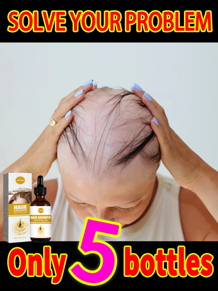 

Solve your problem and let us have more hair