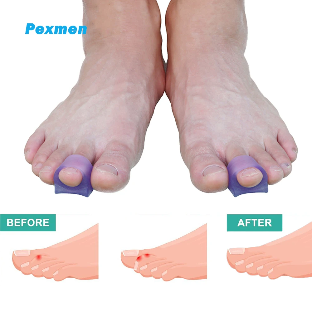 Pexmen 2/4/10Pcs Hammer Toe Corrector Gel Toe Straighteners Realign Bent Curled Crooked Claw and Hammer Toes Bunion Corrector