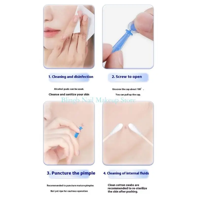 28TA 일회용 여드름 란셋 전문 블랙 헤드 및 여드름 용 흠 제거 도구