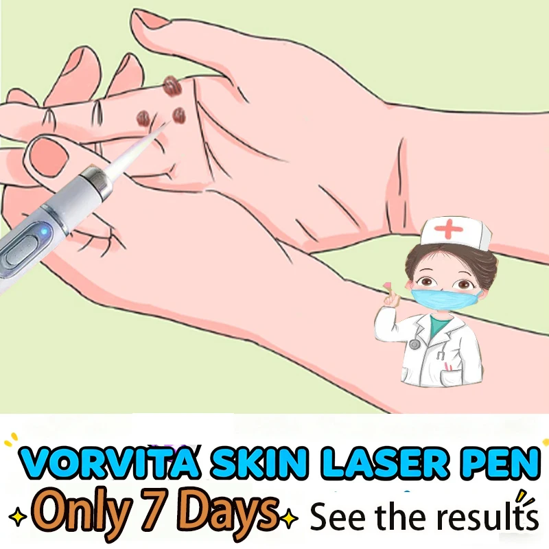 

Модернизированные бородавки 2-го поколения ремонт корня бородавок угло Z26