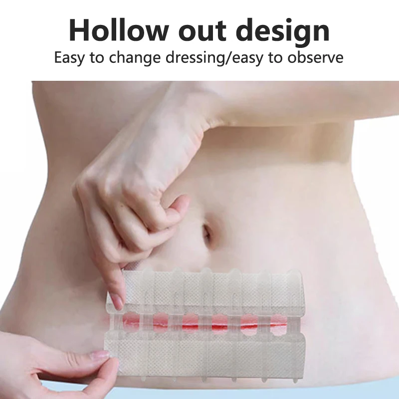 سستة الفرقة المعونة غير مؤلم إغلاق الجرح جهاز خياطة خالية تضميد الجروح بقع البريدي خياطة المخفض الفرقة المعونة في الهواء الطلق المحمولة