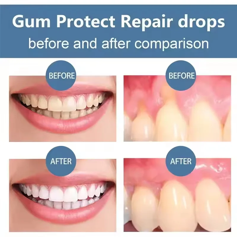 Damaged Gum Repair Care Gel Gum Pain Sensitivity Relief,Deep Cleaning Teeth Stain Tartar Remover,Anti-Cavity Daily Oral Care Gel