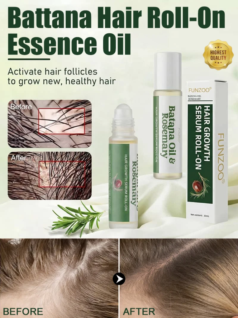 Rodillo Aplicador Portátil de Aceite Esencial para Masaje del Cuero Cabelludo & Cuidado del Cabello, Tratamiento para el Crecimiento del Cabello, Reparación de Puntas Abiertas, Cabello