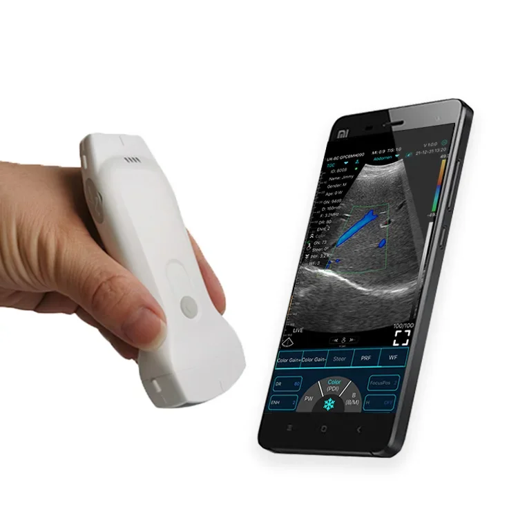 

Pocket Ultrasound Device 128 Elements 3 in 1 Wireless USB Color Doppler Mobile Phone iPhone Pad Ultrasound Scanner Probe