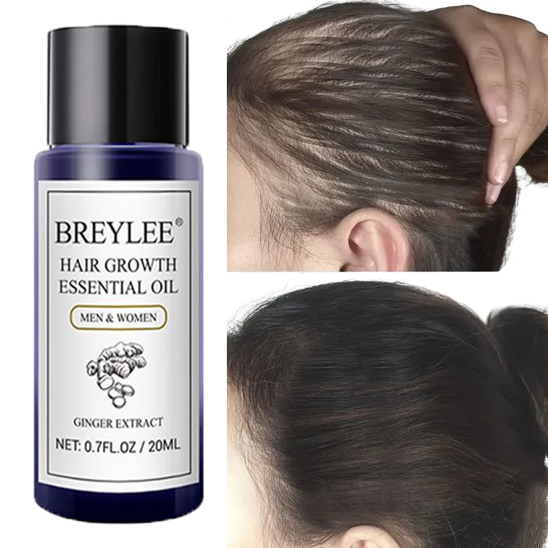 

BREYLEE Ginger Hair Growth Essential Oil Prevent Hair Loss Treatment Scalp Fast Growing Repair Dry Damaged Hair Care Product