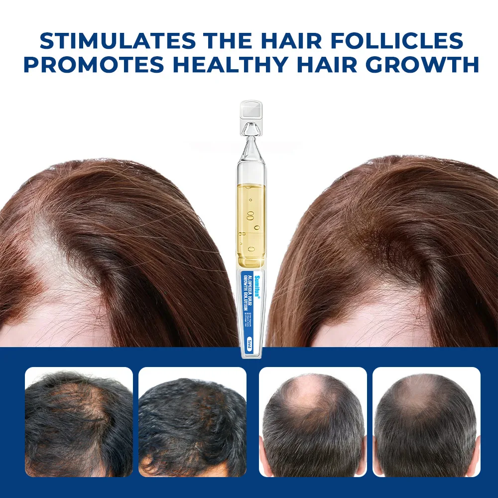 

Набор из 5 одноразовых патчей для лечения алопеции, стимуляции роста волос и ухода за ними, питательный крем-жидкость для волосяных фолликулов и кожи головы K960002