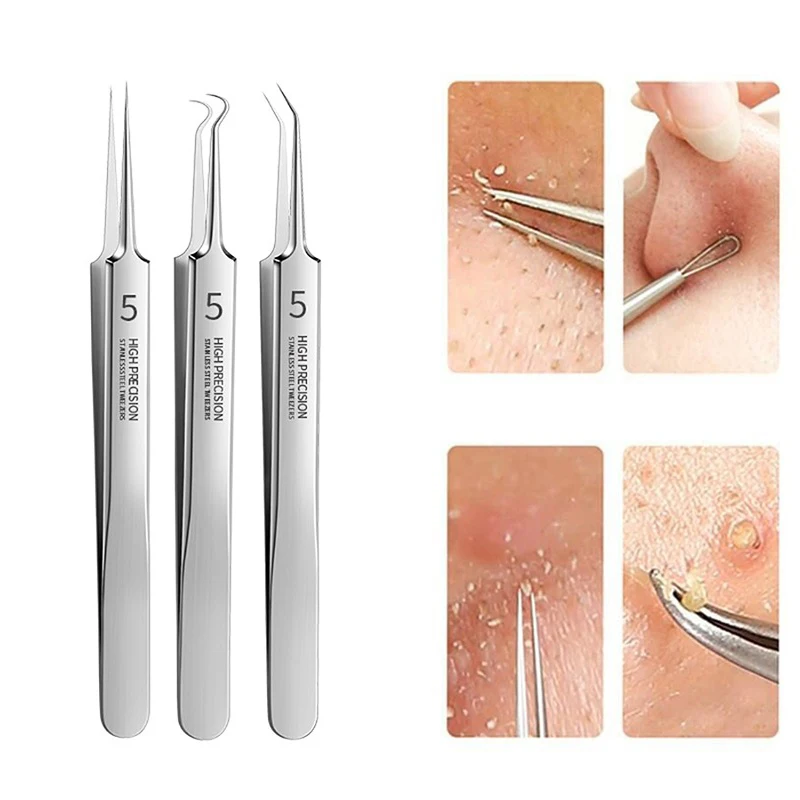 Pinza Profesional N.° 5 para Eliminar Puntos Negros y Acné, Pinzas Ultrafinas, Extractor de Puntos Negros, Aguja para Acné, Limpiador Facial para la Piel