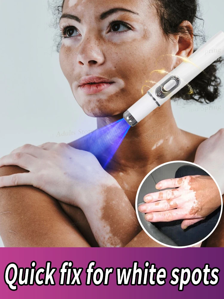 

Effective in 7 days, the most popular product in 2025, no longer troubled by white spots, vitiligo patients
