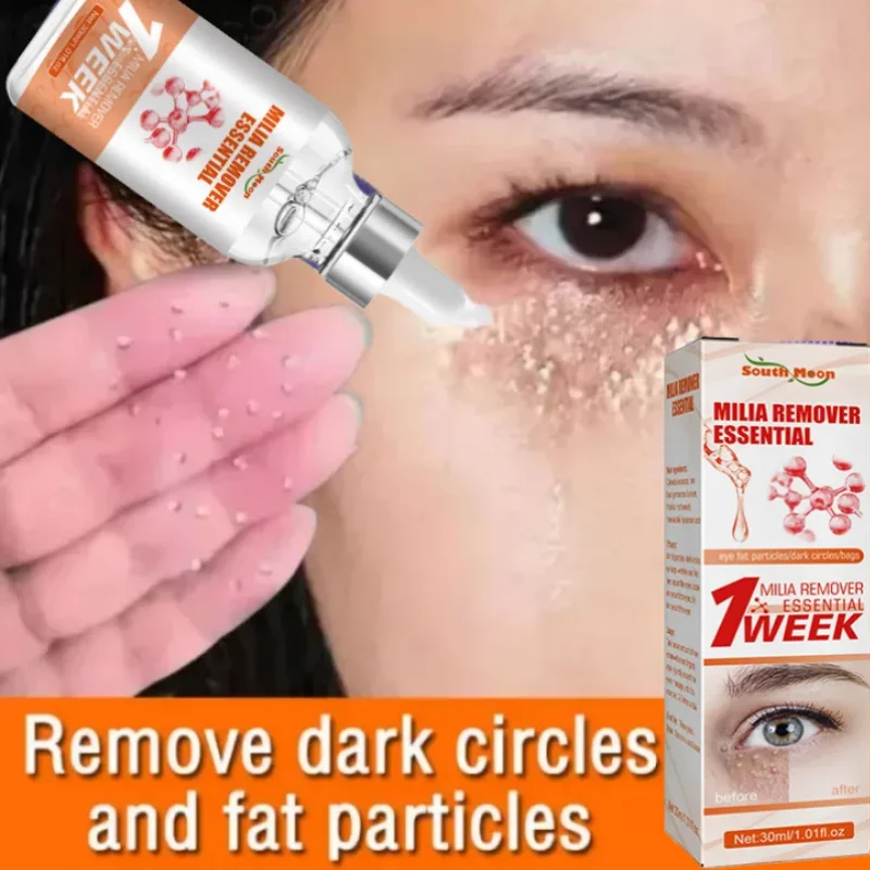 Fat Granules Removal Eye Serum Eye Milia Repair Treatment Products Wrinkle Lifting Moisturizing Anti-Puffiness Korean Skin Care