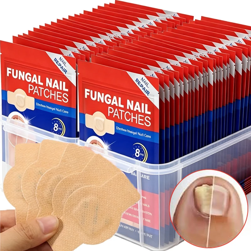 Nail Repair Patches Toenail Fungus Patch Sticky Toenail Care Nail Ingrown Correction Sticker Paronychia Disposable Toe Patch
