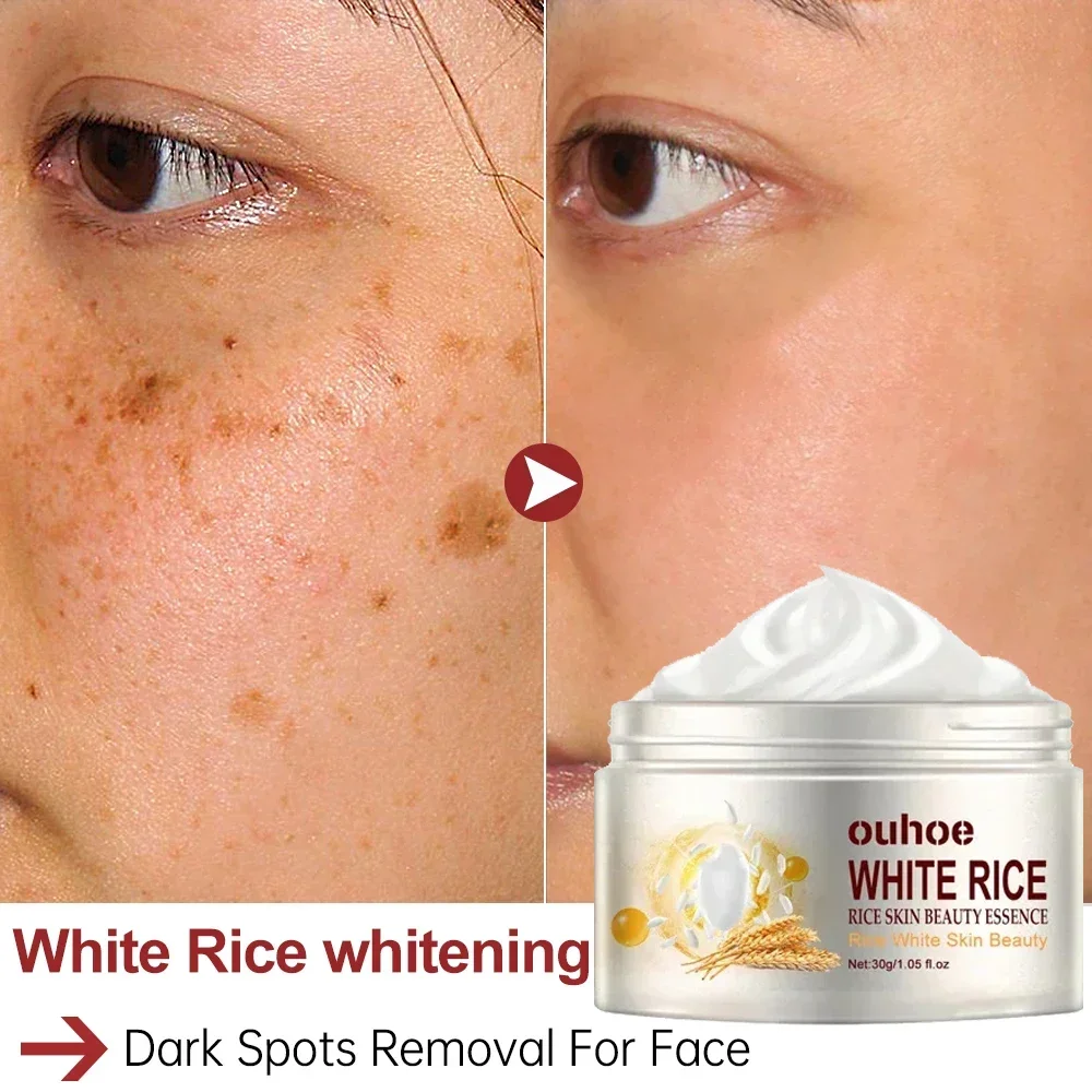 30g White Rice Face Whitening Cream Remove Dark Spots Fade Freckle Melanin Anti Wrinkle Aging Moisturizing Brighten Skin Care