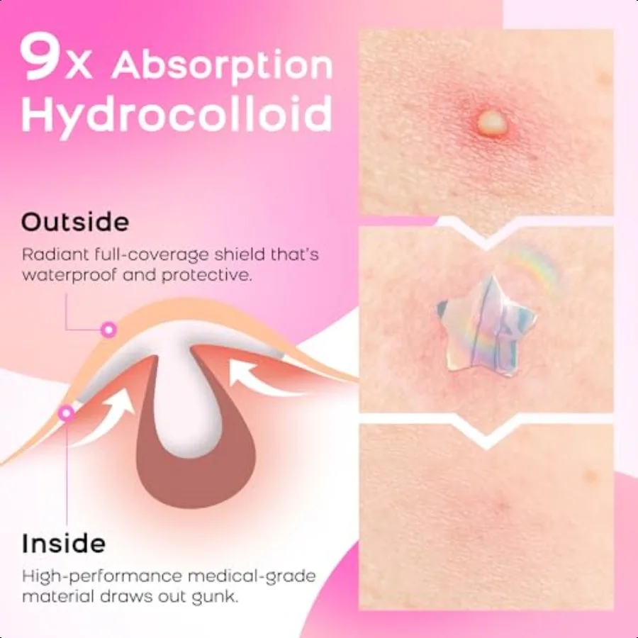 ニキビパッチ 顔用 可愛い ハイドロコロイド ニキビパッチ カラフル ホログラム ハート スポーツステッカー ニキビ跡 ニキビパッチ サイン付き