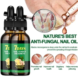 Nail Fungal Treatment Device 7 Days Repair Oil Foot Toe Essence Anti Infection Paronychia Ginger Onychomycosis Gel Care Products