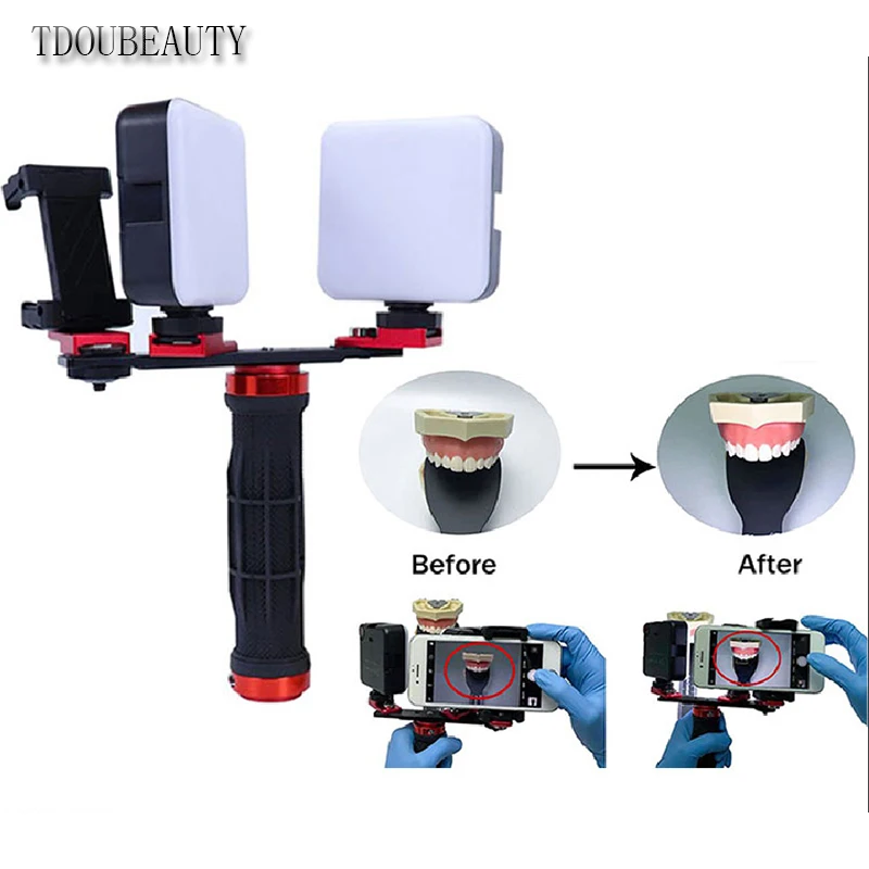 TDOUBEAUTY Oral Auxiliary Lighting, Dental Mobile Phone Fill Light, Oral Shooting Fill Light Equipment USB Charging Method