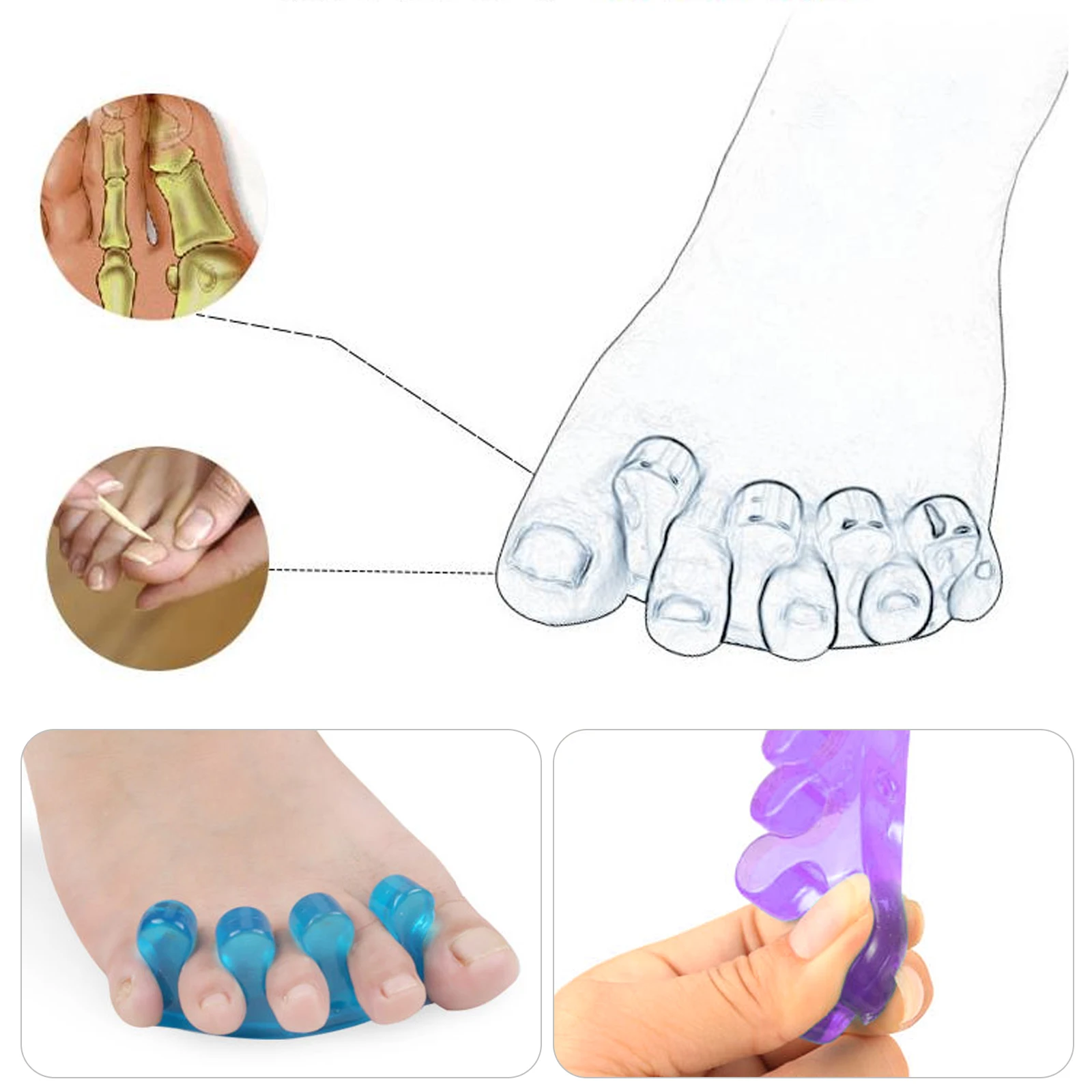 Silicone Toe Separators Correcting Bunions and Restoring Toes Toe Spreaders Toe Straightener for Overlapping Toes Foot Care Tool