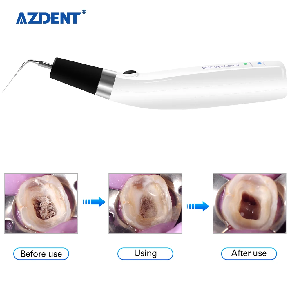 a Quality USB Ultrasonic Dental Endo Irrigator/ Dental Endo Sonic Activator