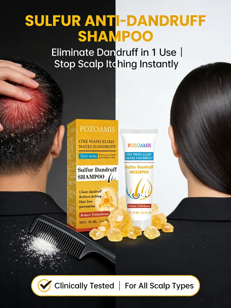 

Шампунь с серой против перхоти для всех типов волос: успокаивает зудящую кожу головы, контролирует жирность, глубоко очищает, ежедневный уход за волосами