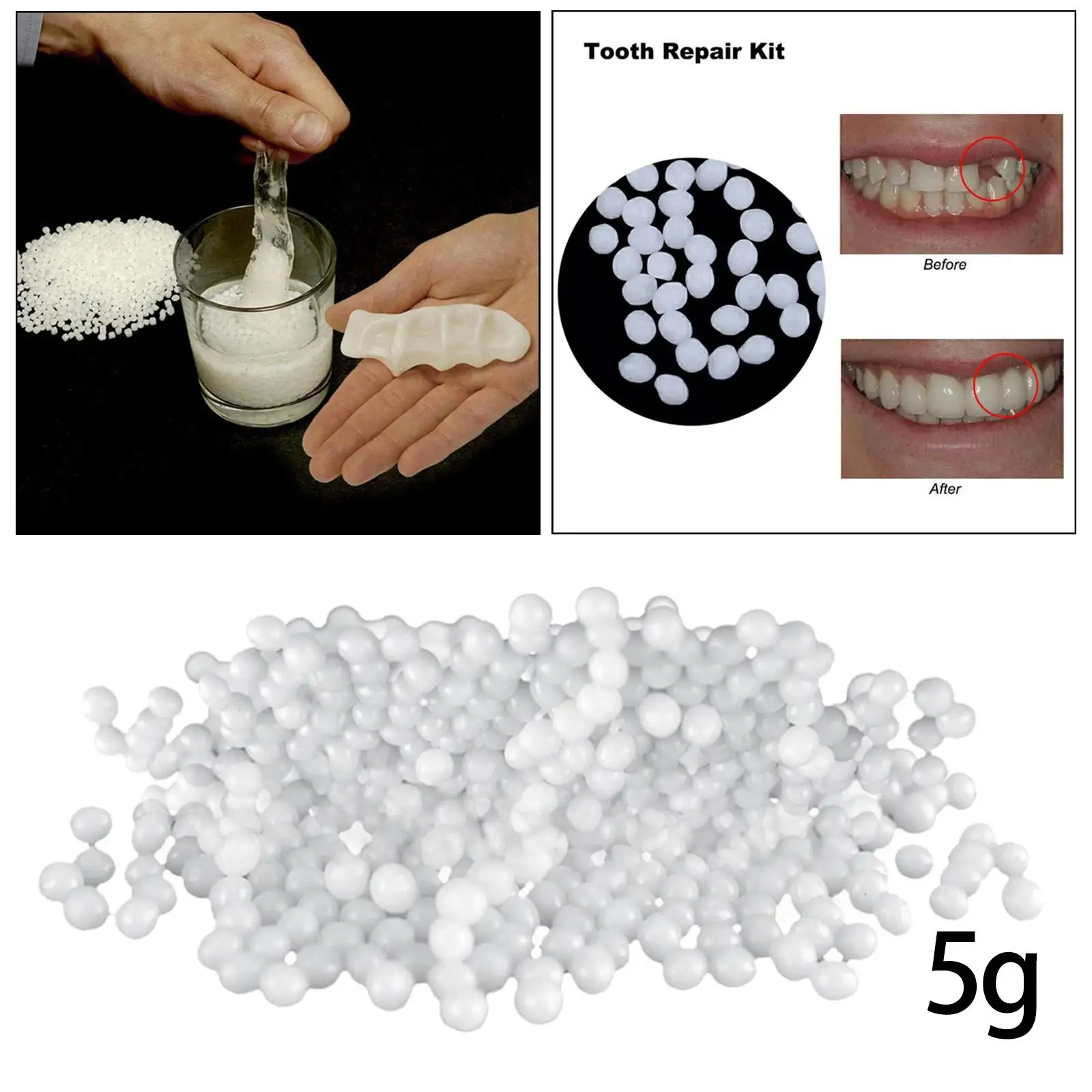 Kit di riparazione temporanea che riempie denti rotti mancanti e spazi vuoti modellabili