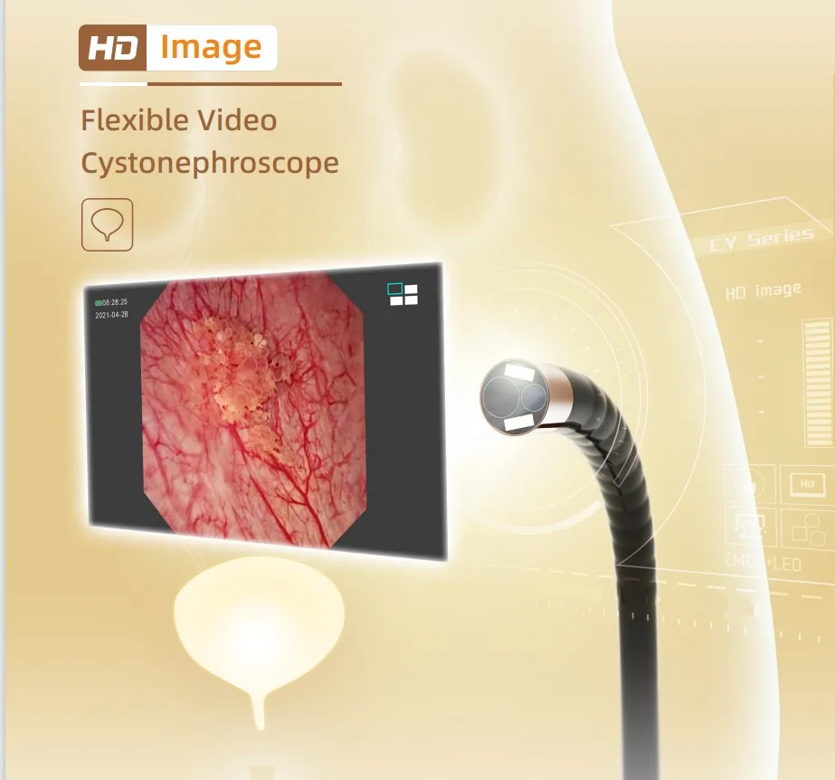 LTEF24B Flexible Video Cystonephroscope Endoscope Ent Medical Hd Image Surgical Video Cystoscope Flexible