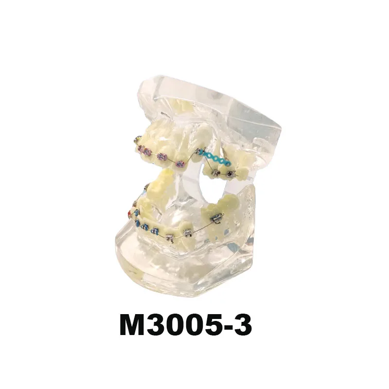1Pcs/Box Dental Orthodontic Standard/Malocclusion Teeth Model With Metal Brackets Red /Transparent Demonstration Typodont Model