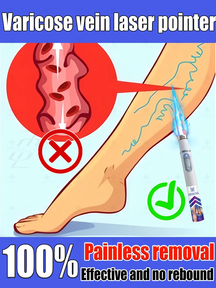 

Reverse leg health in 7 days and say goodbye to varicose vein recurrence