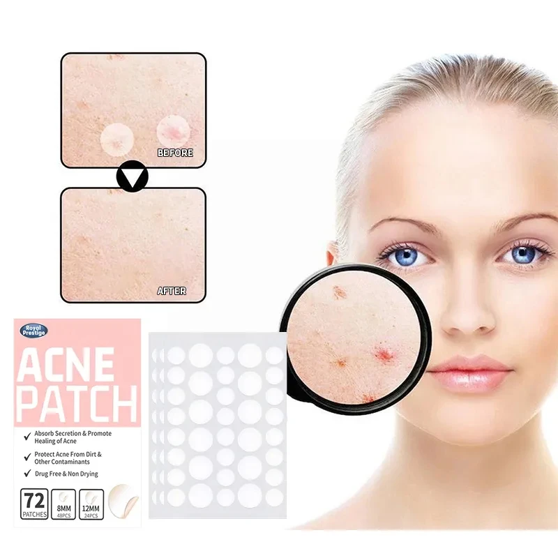 72 Stuks Onzichtbare Acne Patches Verwijdering Puistje Anti-Acne Hydrocolloïde Pleisters Vlekken Markeren Concealer Reparatie Sticker Waterdicht