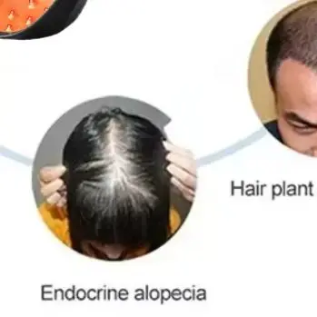 

Red Light Therapy For Hair Growth Cap Laser Therapy Device For Hair Loss Treatment With USB Charging Anti-hair