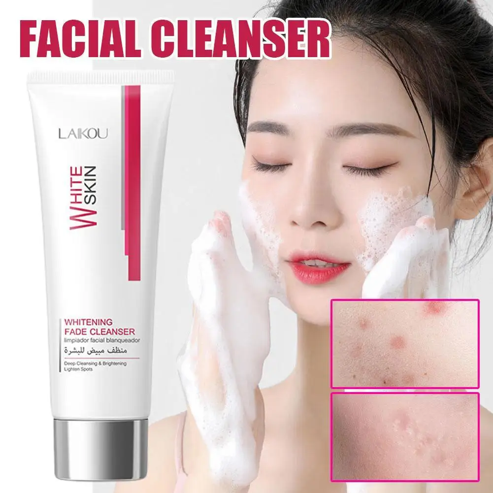 80g Nicotinamid White ning Gesichts reiniger Gesichts peeling Reinigung Akne Öl Kontrolle Mitesser Entferner Schrumpfen Poren Hautpflege