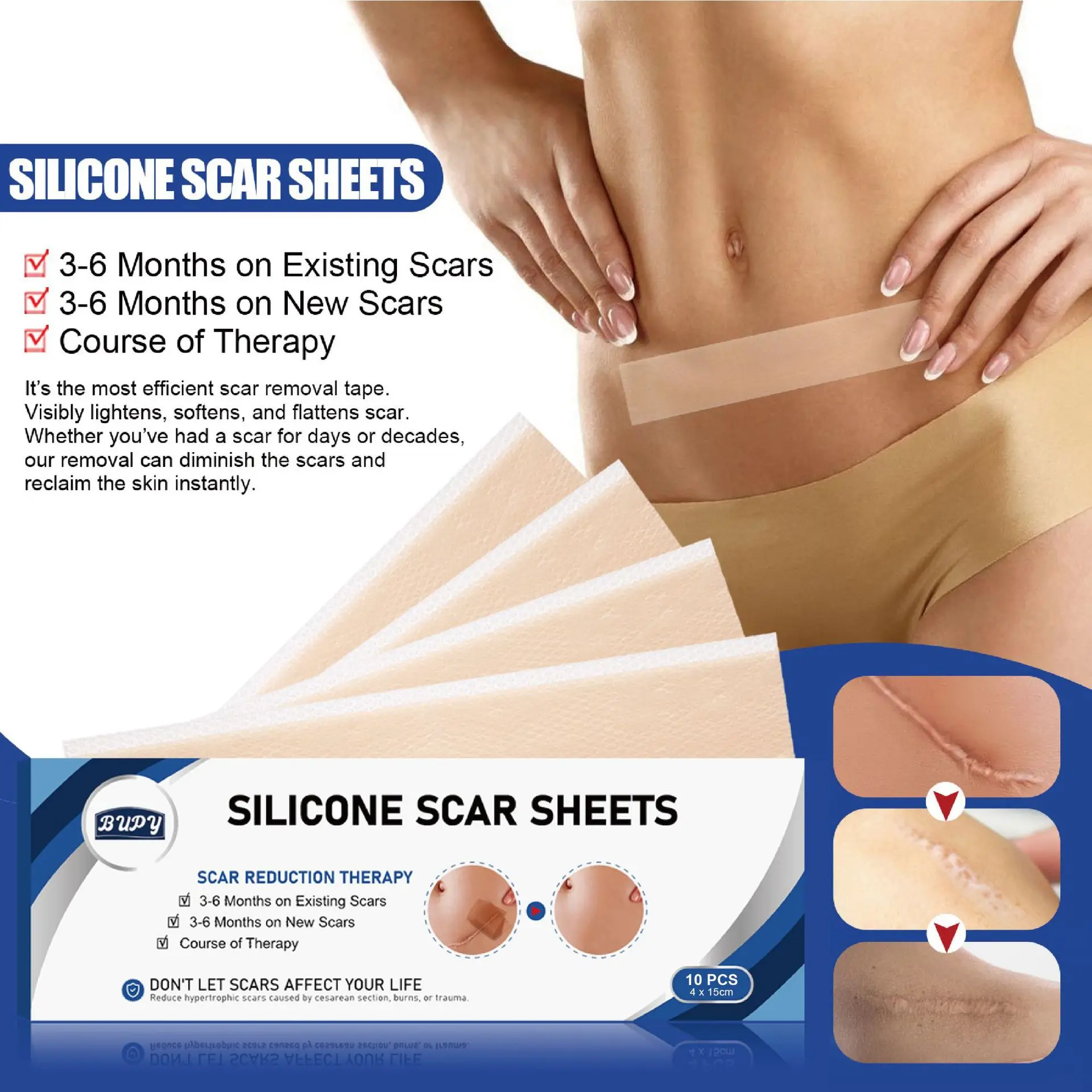 

Пластырь для шрама Bupy, самоклеящаяся нашивка для шрама, силиконовый гель, ремонт, невидимая нашивка в стиле cesarean, 15 см, цельная деталь