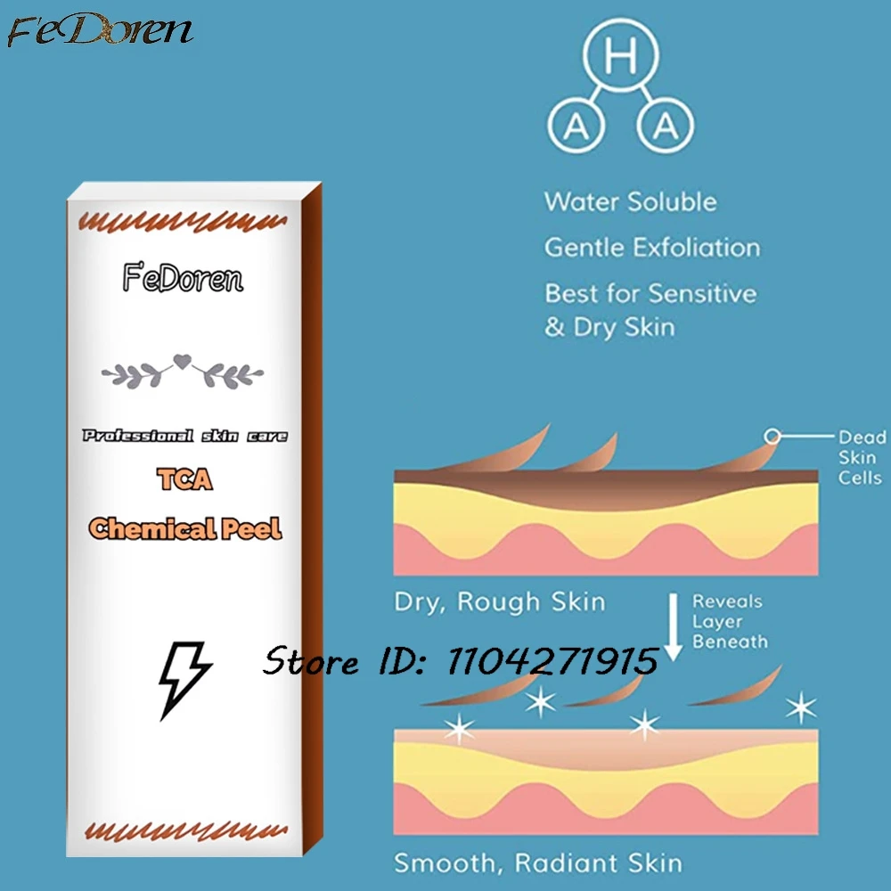 30 مللي حمض الجليكوليك TCA قشر كيميائي 70%/20% تقشير حمض الجلد إزالة الجلد Superforce تقشير العناية بالبشرة #4