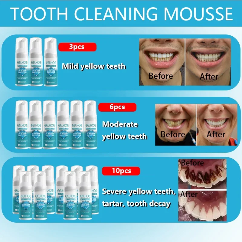 Creme dental tipo push para remover o tártaro, cárie dentária, creme dental mousse para limpeza profunda, branqueamento dos dentes, respiração