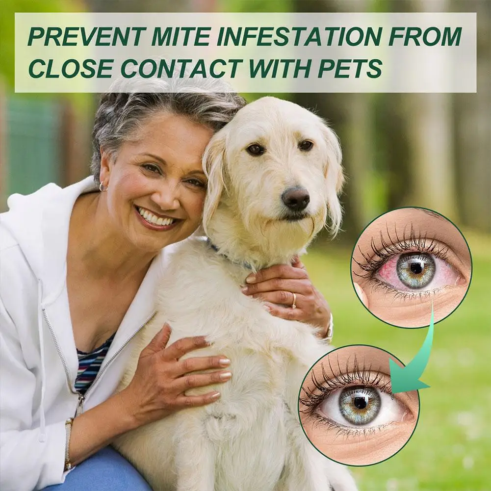20Pcs Eyelid Cleansing Wipes Mite Removal Wet Wipes Natural Eyelash Makeup Remover For Blepharitis Itchy Stye Eyes