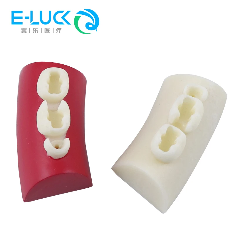 Dental Inlay Exercise Model Block Composite Resin Filling Practice Models for Dentistry Oral Teeth Teaching Typodont Study
