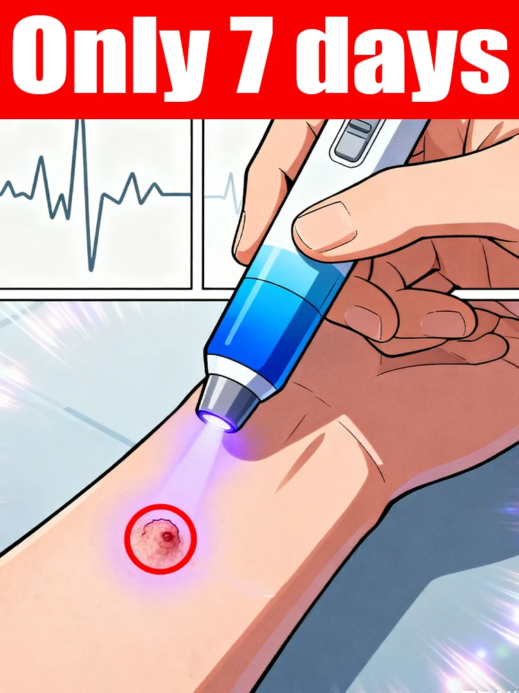 

Bᴇsᴛ-sᴇʟʟɪɴɢ ʙʟᴜᴇ ʟɪɢʜᴛ ᴡᴀʀᴛ ᴘᴇɴ, ʙᴏᴅʏ ᴡᴀʀᴛ ʀᴇᴍᴏᴠᴀʟ ᴛᴏᴏʟs